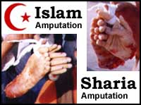 Sharia Amputation