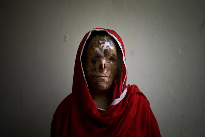 Najaf Sultana burned alive for being a girl